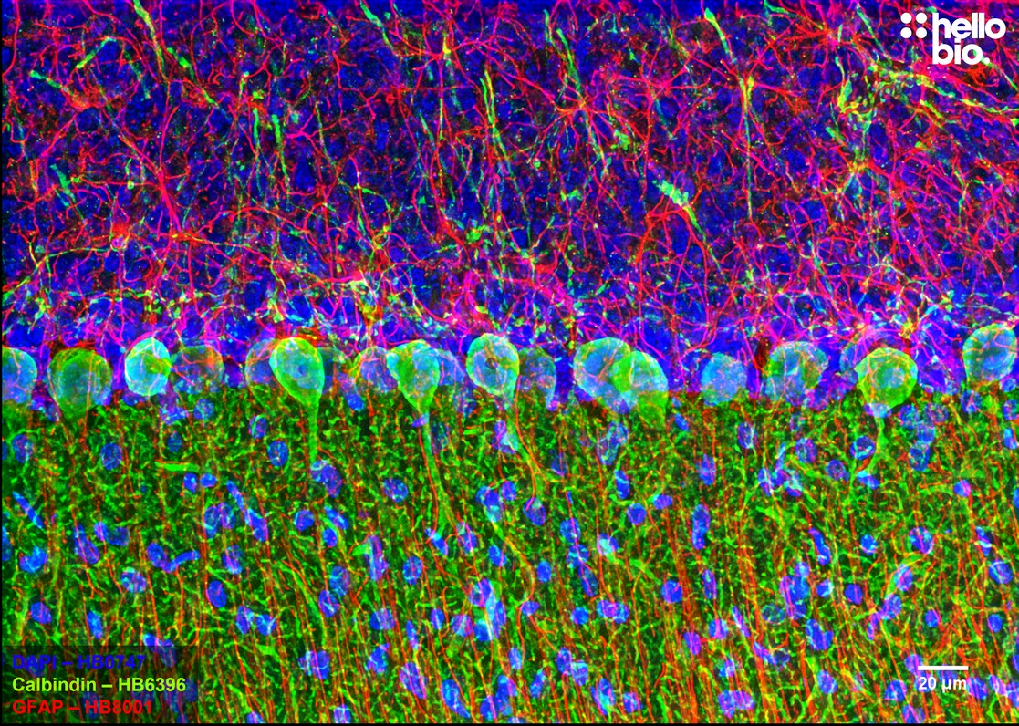 Figure 1. Calbindin and GFAP staining in the cerebellum. Mounted using MightyMount<sup>TM</sup> Antifade Fluorescence Mounting Medium with DAPI (hardset)