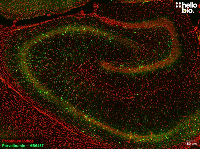 Figure 2. Parvalbumin staining in rat hippocampus. Mounted using MightyMount<sup>TM</sup> Antifade Fluorescence Mounting Medium with Propidium Iodide (aqueous).