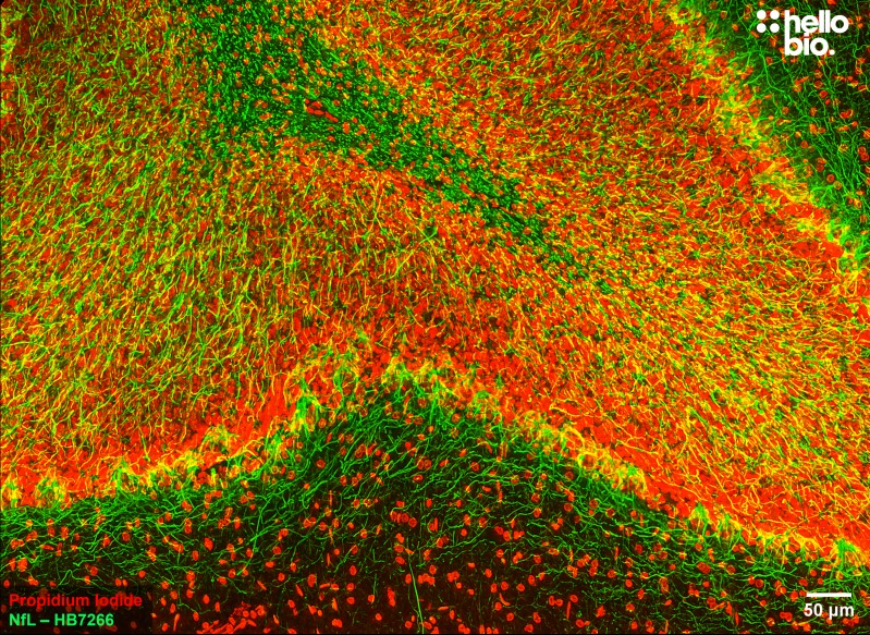 Figure 6. Neurofilament L staining in rat dentate gyrus. Mounted using MightyMount<sup>TM</sup> Antifade Fluorescence Mounting Medium with Propidium Iodide (aqueous).