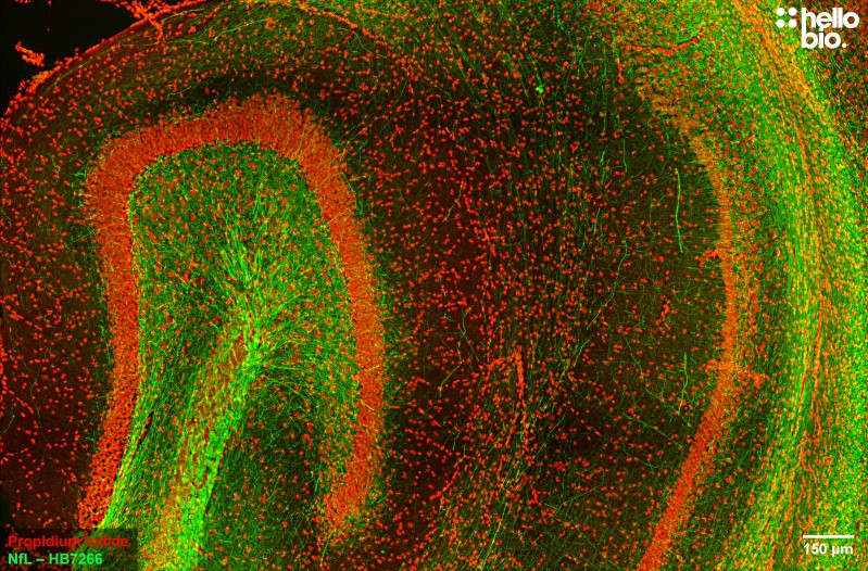 Figure 3. Neurofilament L staining in rat hippocampus. Mounted using MightyMount<sup>TM</sup> Antifade Fluorescence Mounting Medium with Propidium Iodide (aqueous).