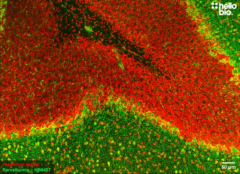 Figure 7. Parvalbumin staining in rat cerebellum. Mounted using MightyMount<sup>TM</sup> Antifade Fluorescence Mounting Medium with Propidium Iodide (aqueous).