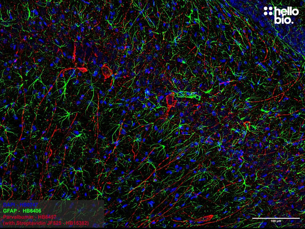 Figure 2.  Parvalbumin expressing interneurons and GFAP expressing astrocytes in the rat hippocampus.