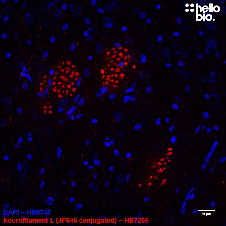 Figure 5. Janelia Fluor® 646 conjugated anti-neurofilament light antibody staining in rat brainstem