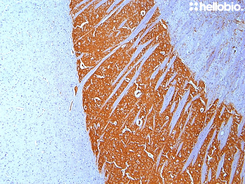 Figure 2. Tyrosine hydroxylase staining in rat striatum visualized using biotin-streptavidin detection.