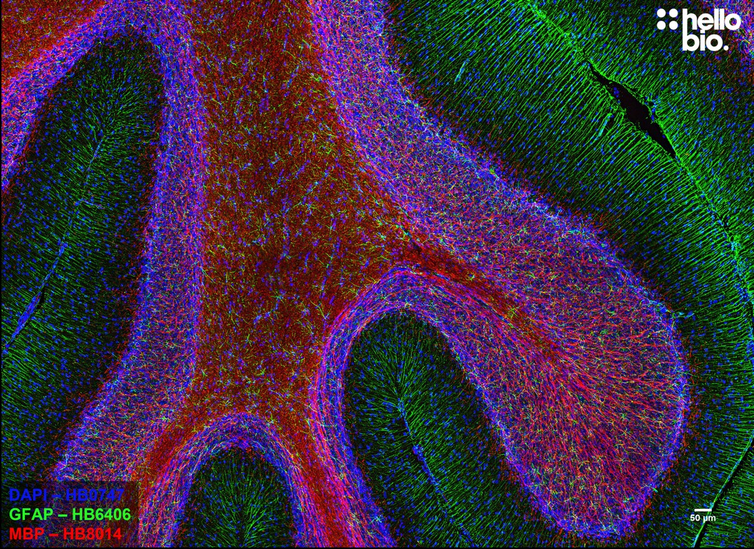 Figure 4. GFAP and MBP staining in rat cerebellum. Mounted using MightyMount<sup>TM</sup> Antifade Fluorescence Mounting Medium (hardset).