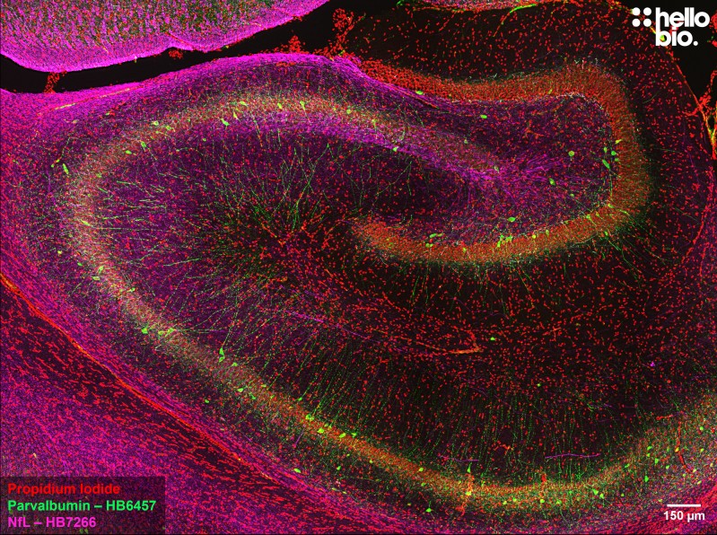 Figure 5. Parvalbumin and Neurofilament L staining in rat hippocampus. Mounted using MightyMount<sup>TM</sup> Antifade Fluorescence Mounting Medium with Propidium Iodide (aqueous).