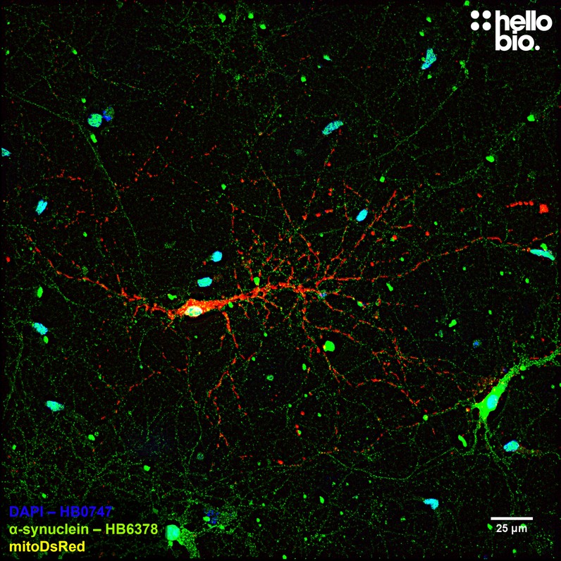 Figure 5. α-Synuclein staining in mitoDsRed transfected cultured rat hippocampal neurons.