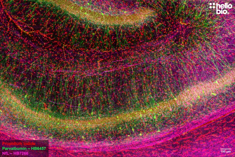 Figure 1. Parvalbumin and Neurofilament L staining in rat hippocampus. Mounted using MightyMount<sup>TM</sup> Antifade Fluorescence Mounting Medium with Propidium Iodide (aqueous).