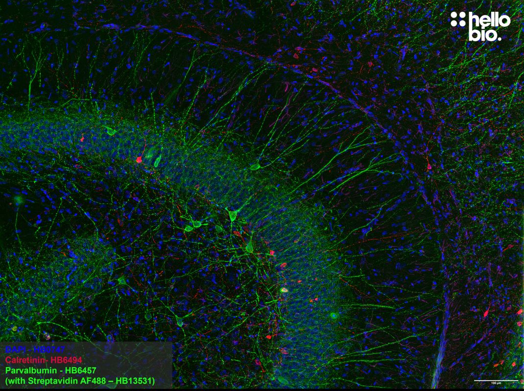 Figure 1. Parvalbumin and Calretinin expressing interneurons in the rat hippocampus.