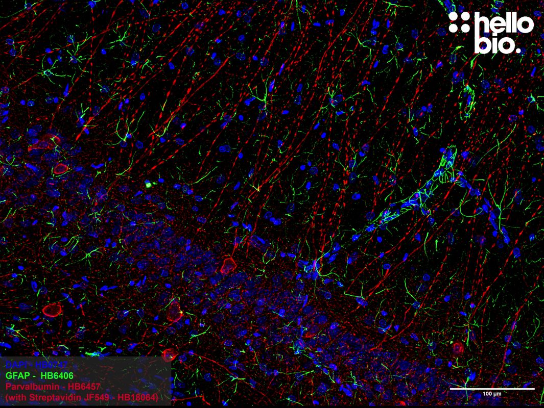 Figure 2. Parvalbumin positive interneurons and GFAP positive astrocytes in the rat hippocampus.