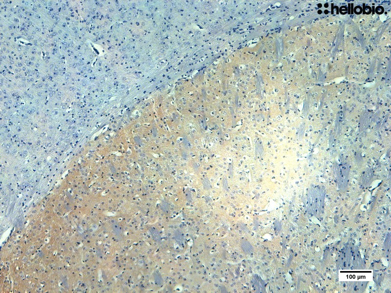 Figure 4. Tyrosine hydroxylase staining in mouse striatum with hematoxylin counterstain