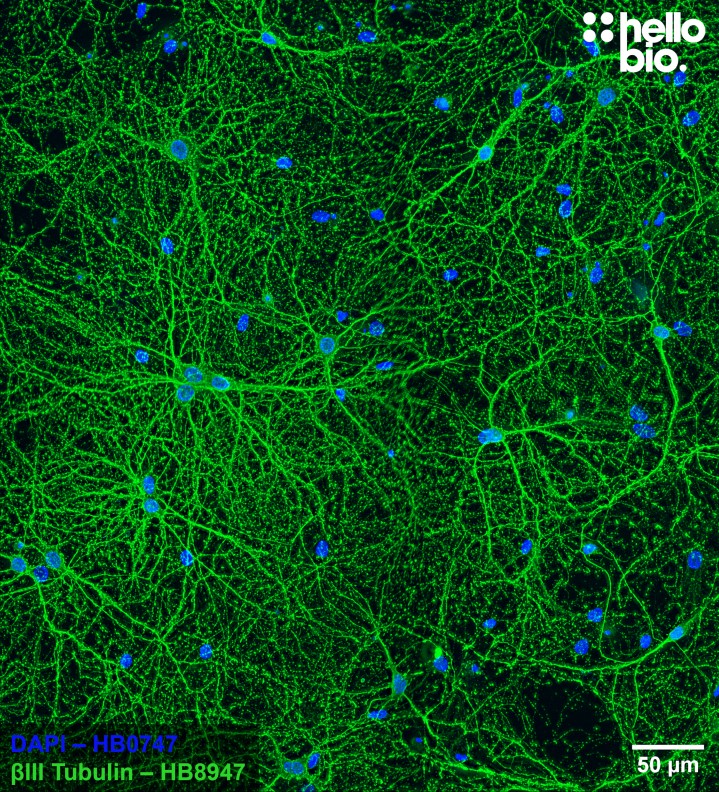 Figure 5. βIII tubulin staining with HB8947 of cultured rat hippocampal neurons.