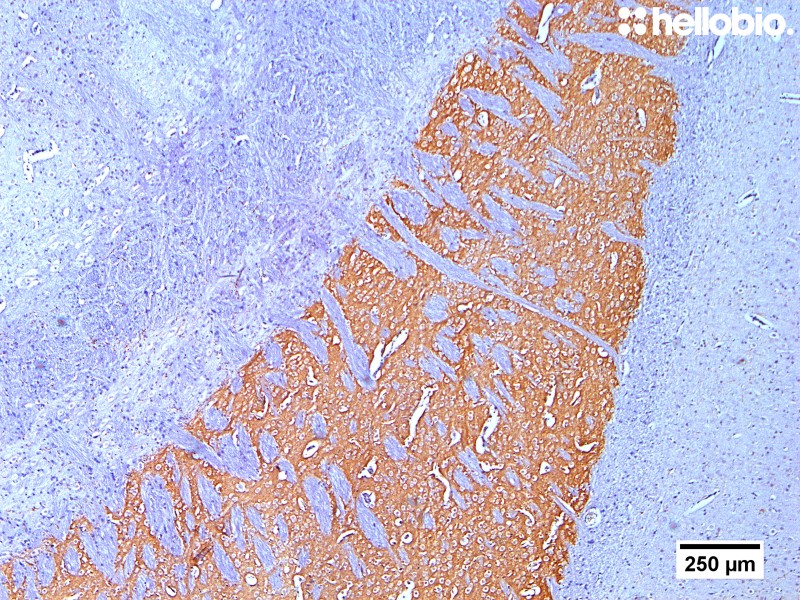 Figure 2. Tyrosine hydroxylase staining in rat striatum visualized using biotin-streptavidin detection.