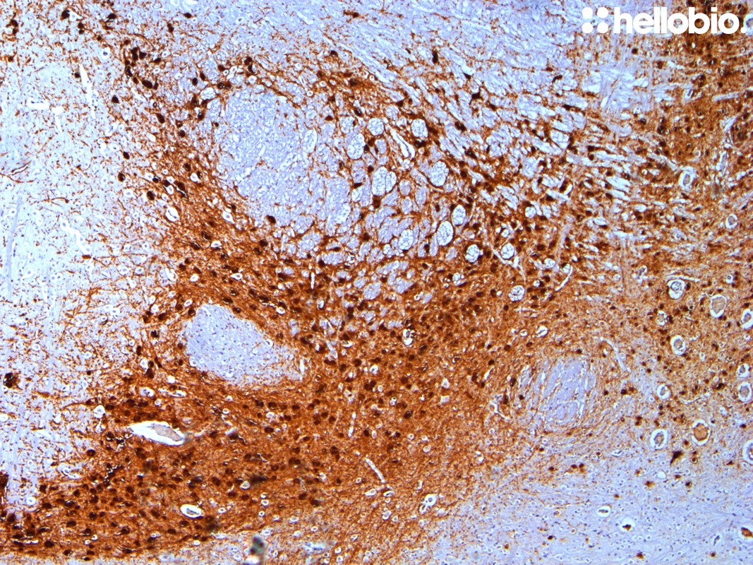 Figure 11. Tyrosine hydroxylase staining of dopaminergic nuclei in rat midbrain visualized using biotin-streptavidin detection.