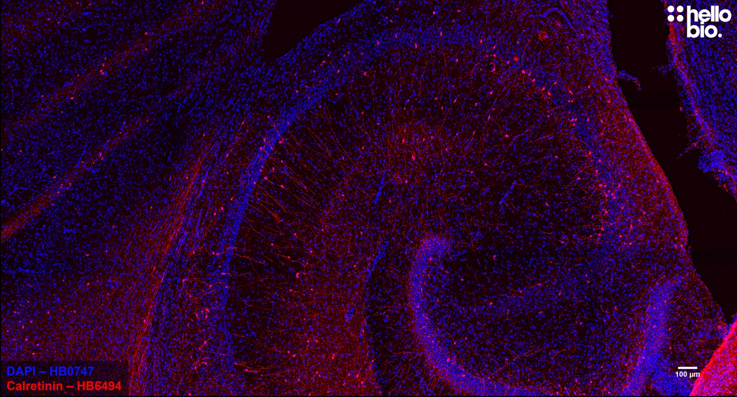 Figure 5. Calretinin staining in rat hippocampus. Mounted using MightyMount<sup>TM</sup> Antifade Fluorescence Mounting Medium (hardset).
