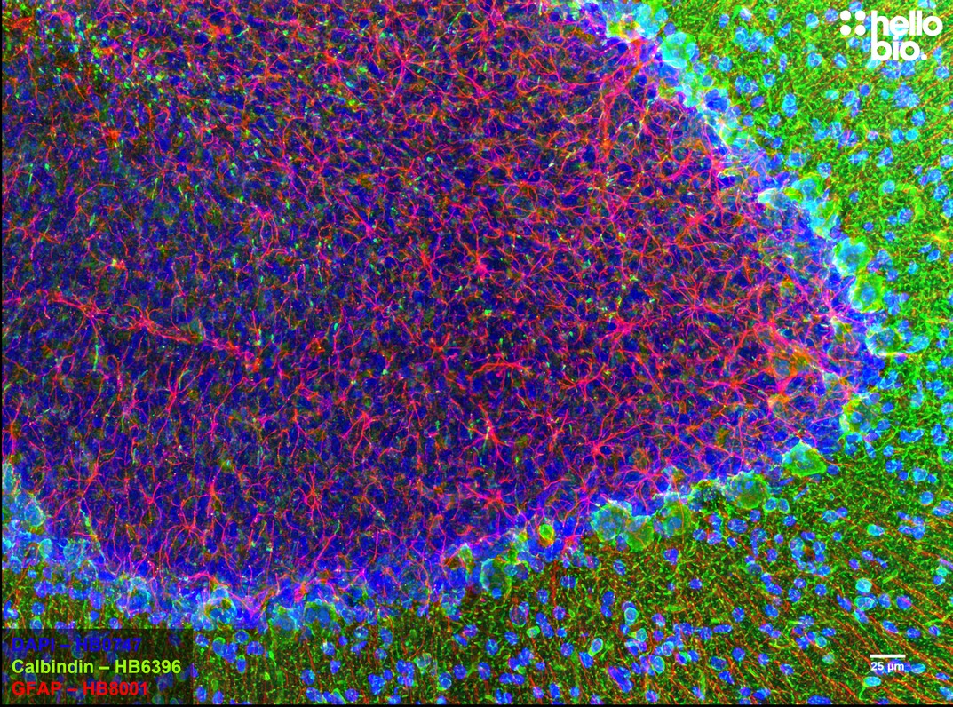 Figure 4. Calbindin and GFAP staining in the cerebellum. Mounted using MightyMount<sup>TM</sup> Antifade Fluorescence Mounting Medium with DAPI (hardset)