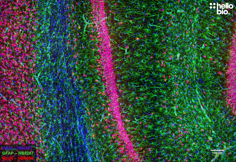 Figure 2. GFAP and NeuN staining in rat hippocampus. Mounted using MightyMount<sup>TM</sup> Antifade Fluorescence Mounting Medium (aqueous).