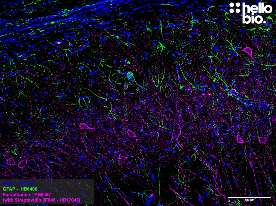 Figure 1. Parvalbumin positive interneurons and GFAP positive astrocytes in the rat hippocampus.