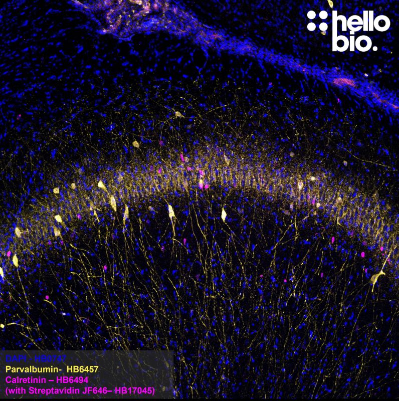 Figure 2. Calretinin and Parvalbumin expression in rat hippocampus.