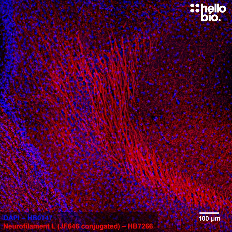 Figure 2. Janelia Fluor® 646 conjugated anti-neurofilament light antibody staining in rat hippocampus