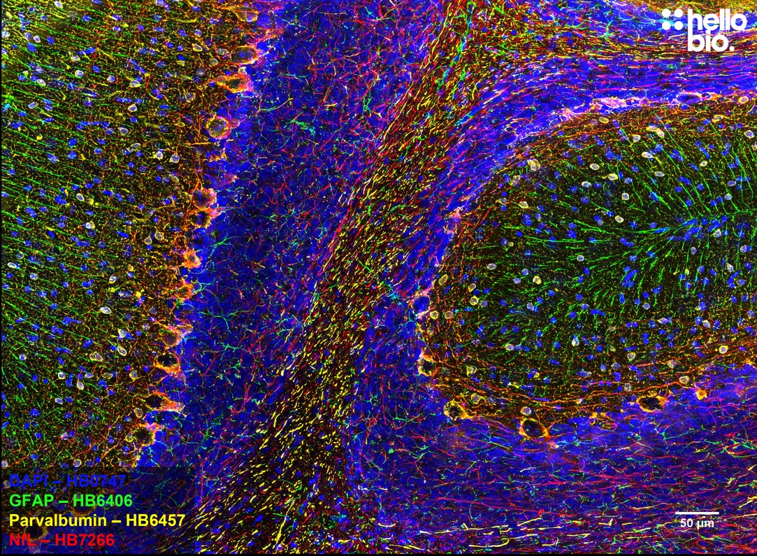 Figure 6. GFAP, Parvalbumin and Neurofilament Light staining in rat cerebellum. Mounted using MightyMount<sup>TM</sup> Antifade Fluorescence Mounting Medium (hardset).
