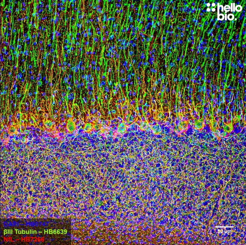 Figure 8. βIII-tubulin and Neurofilament light staining in rat cerebellum. Mounted using MightyMount<sup>TM</sup> Antifade Fluorescence Mounting Medium (aqueous).