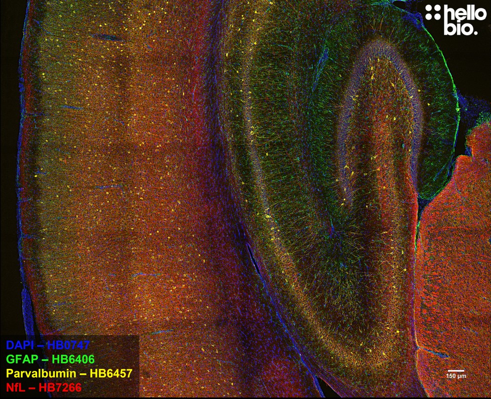Figure 7. GFAP, Parvalbumin and Neurofilament Light staining in rat cerebellum and cortex. Mounted using MightyMount<sup>TM</sup> Antifade Fluorescence Mounting Medium (hardset).