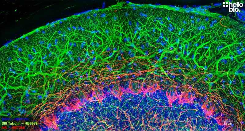 Figure 1. βIII-tubulin and Neurofilament light staining in rat cerebellum. Mounted using MightyMount<sup>TM</sup> Antifade Fluorescence Mounting Medium (aqueous).