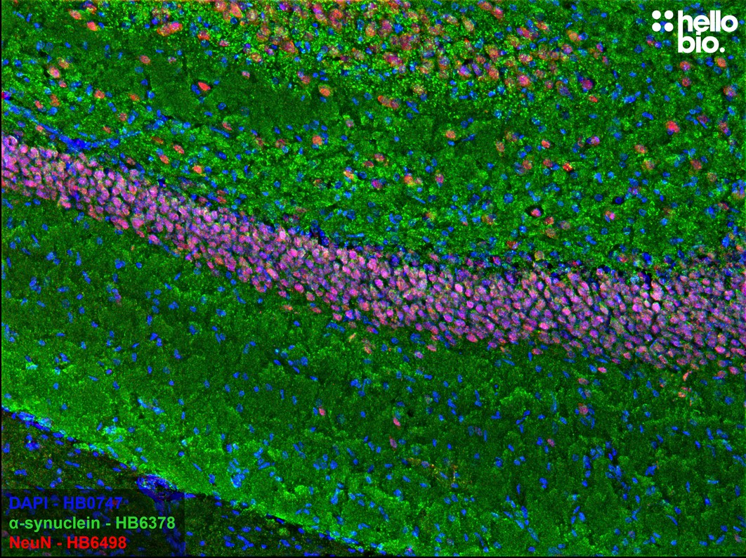 Figure 6. α-Synuclein staining in rat hippocampal CA1