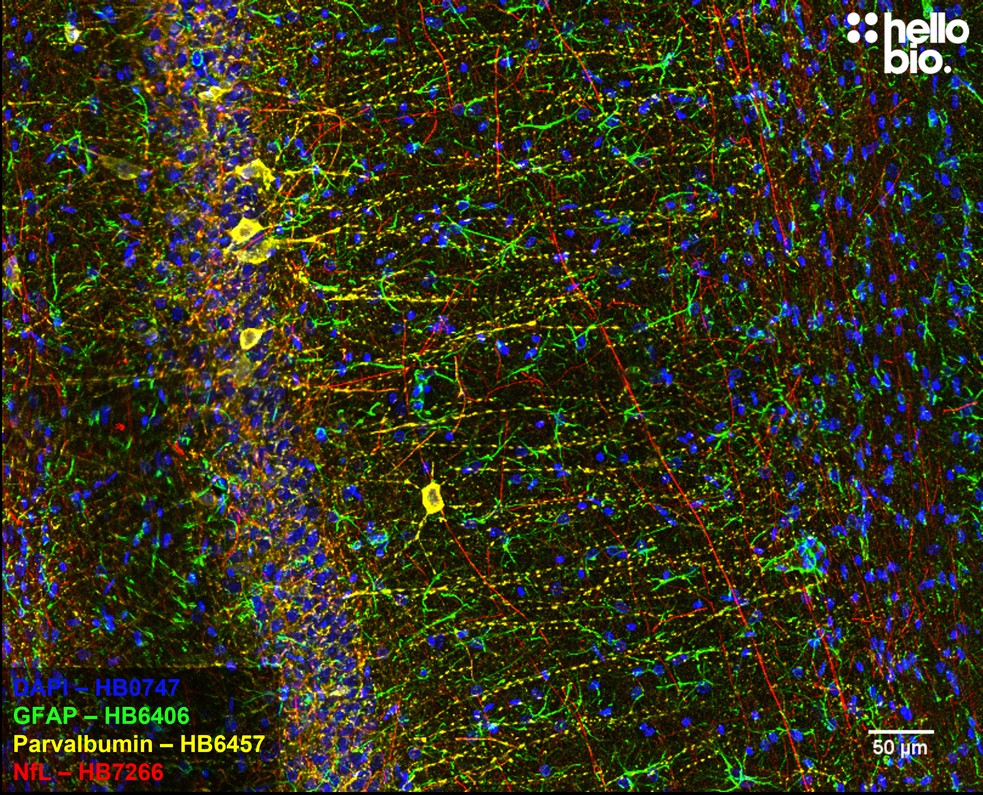 Figure 8. GFAP, Parvalbumin and Neurofilament Light staining in rat CA1. Mounted using MightyMount<sup>TM</sup> Antifade Fluorescence Mounting Medium (hardset).