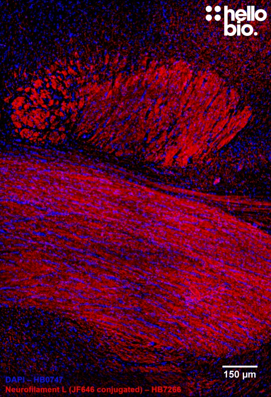 Figure 6. Janelia Fluor® 646 conjugated anti-neurofilament light antibody staining of rat corpus callosum