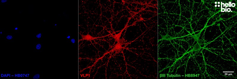 Figure 6. Cultured neurons expressing both βIII tubulin and VLP1.