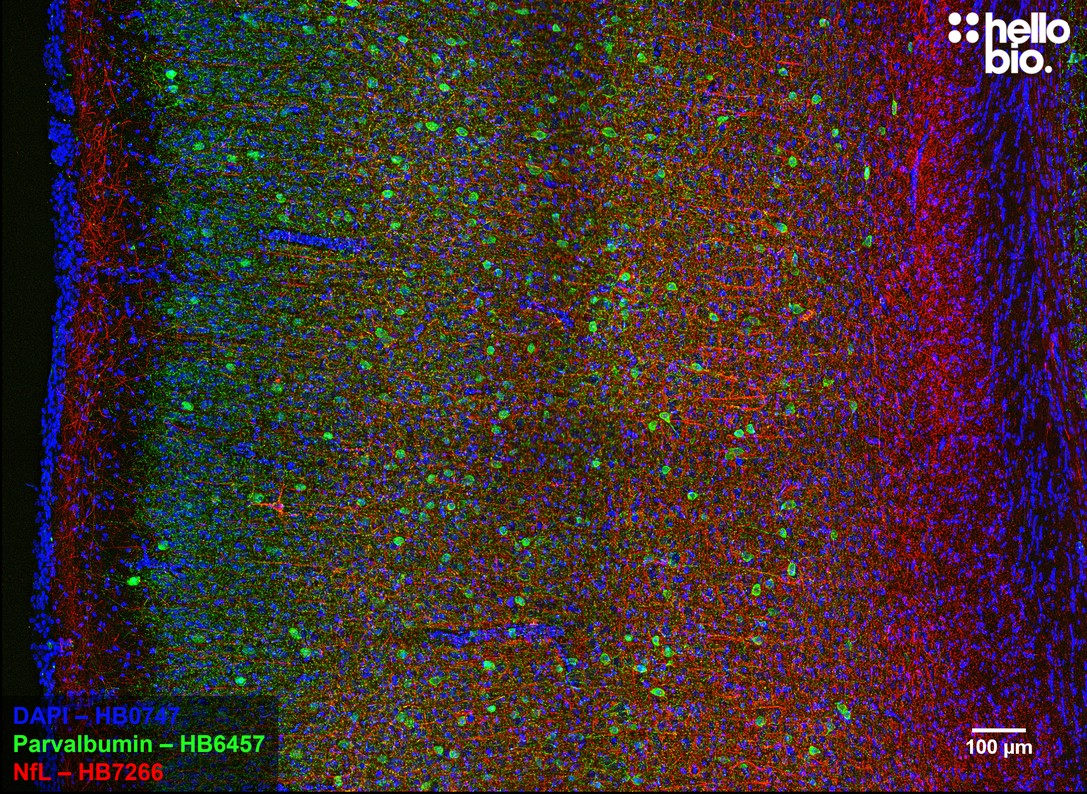 Figure 9. Parvalbumin and Neurofilament Light staining in rat cortex. Mounted using MightyMount<sup>TM</sup> Antifade Fluorescence Mounting Medium (hardset).