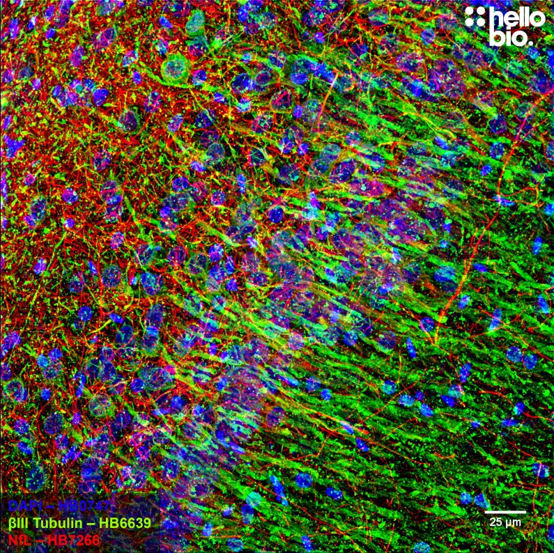 Figure 6. βIII-tubulin and Neurofilament light staining in rat cortex. Mounted using MightyMount<sup>TM</sup> Antifade Fluorescence Mounting Medium (aqueous).
