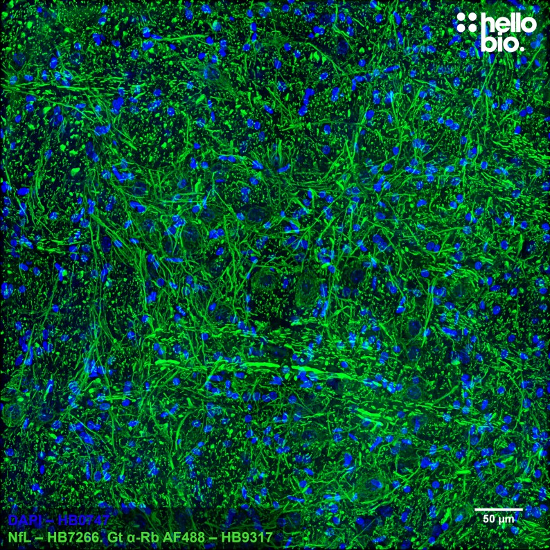 Figure 3. Neuronal projections stained for Neurofilament L (NfL) in rat brainstem using HB7266 and HB9317 Goat Anti-Rabbit H&L (AF488).