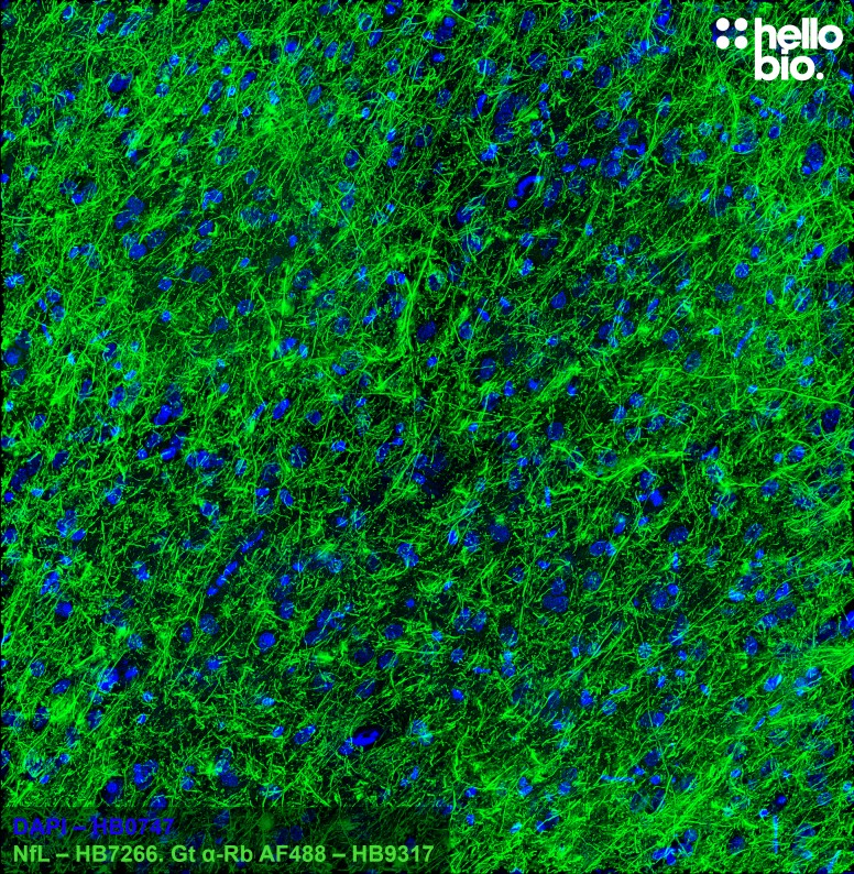 Figure 6. Neuronal projections stained for Neurofilament L (NfL) in rat cortex using HB7266 and HB9317 Goat Anti-Rabbit H&L (AF488).