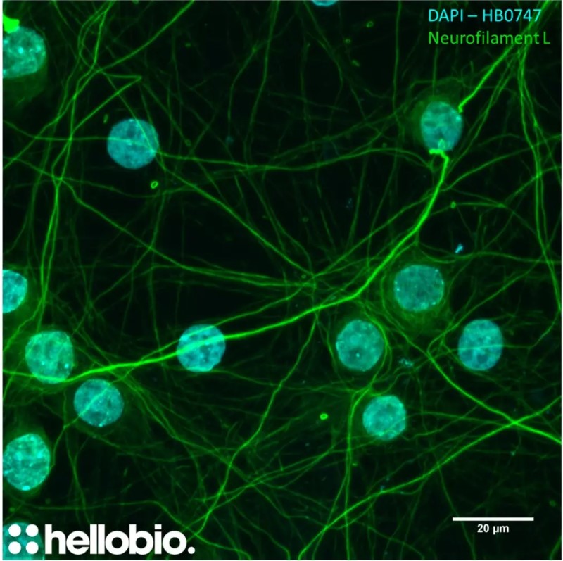 Figure 1. Neurofilament L and DAPI co-staining in hippocampal cell culture. 