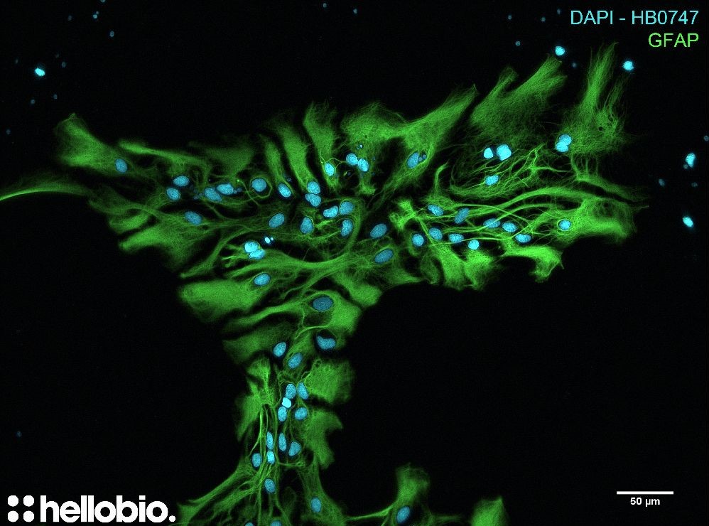 Figure 2. GFAP and DAPI co-staining in hippocampal cell culture
