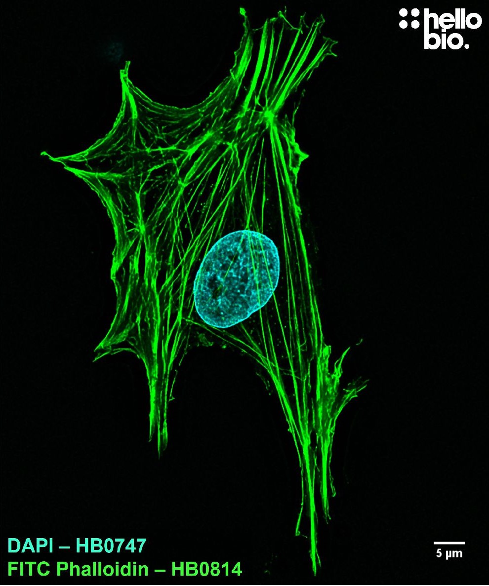 Figure 1. FITC Phalloidin and DAPI co-staining in a fibroblast observed in neuronal cell culture