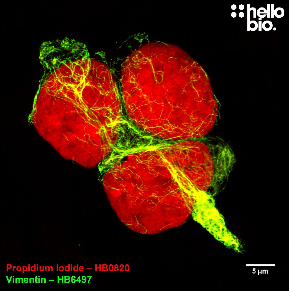 Figure 2. Vimentin and Propidium lodide co-staining in HEK293T cells
