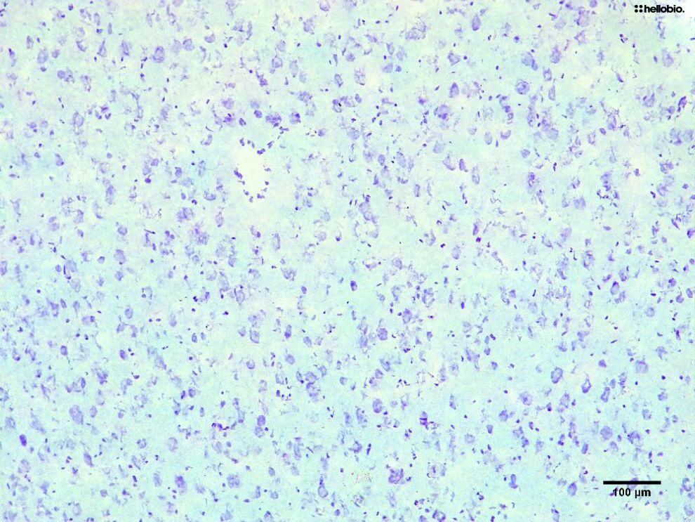 Figure2. Cresyl Violet staining in formalin fixed rat prefrontal cortex