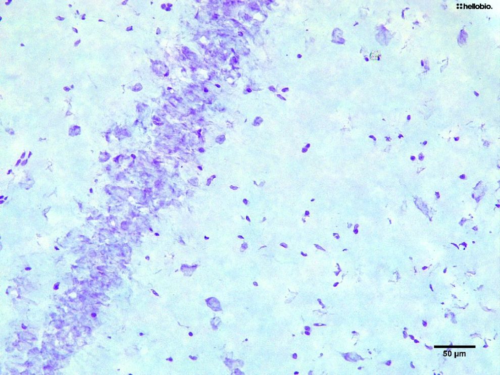 Figure3. Cresyl Violet staining in formalin fixed rat CA