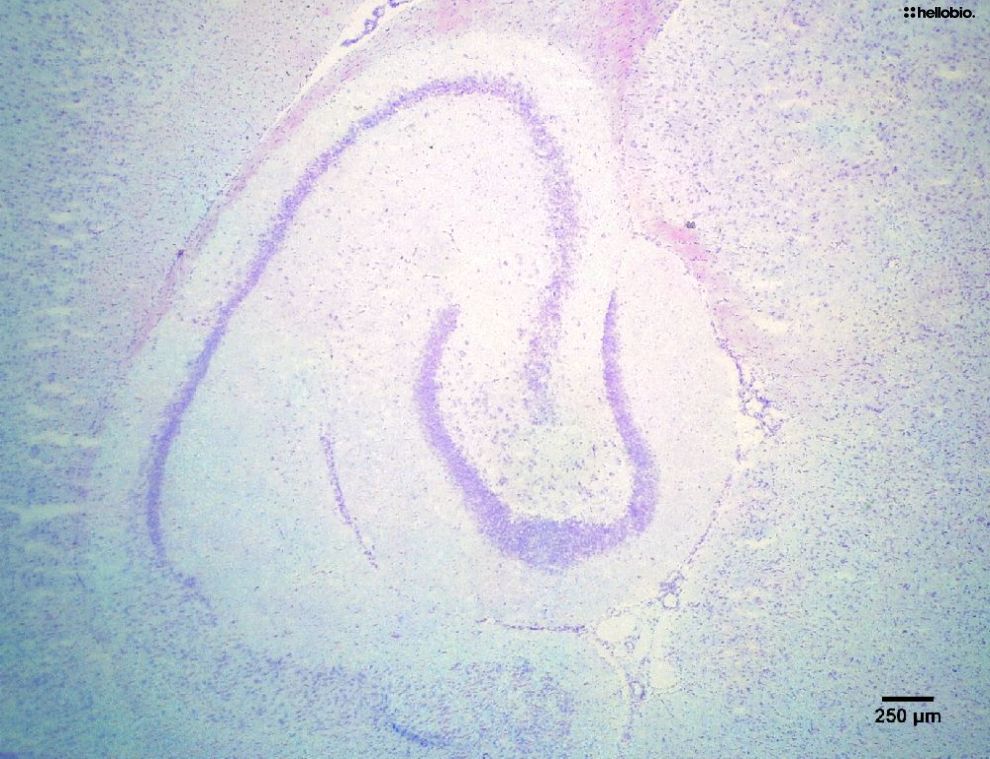 Figure4. Cresyl Violet staining in formalin fixed rat hippocampus