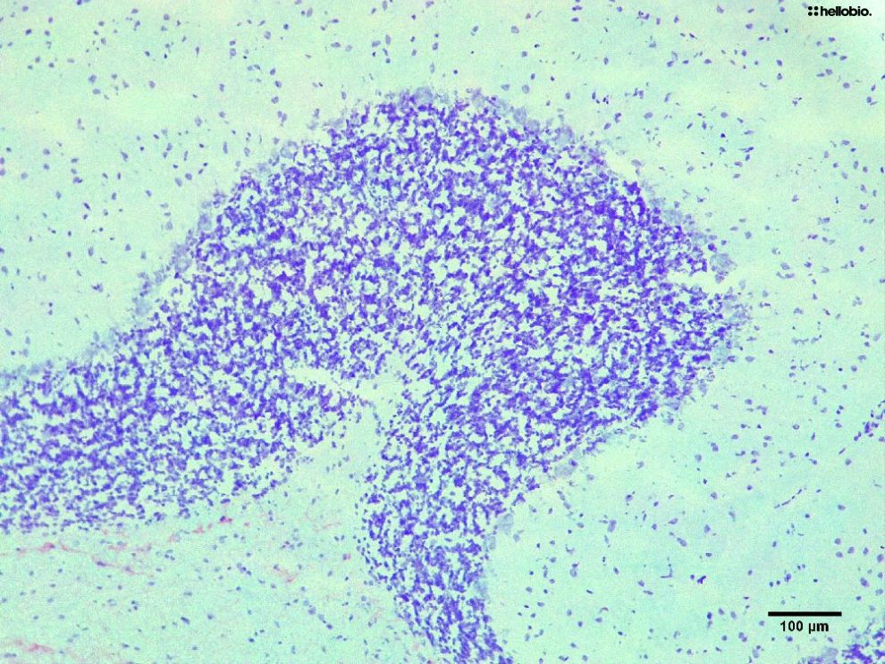 Figure5. Cresyl Violet staining in formalin fixed rat cerebellum