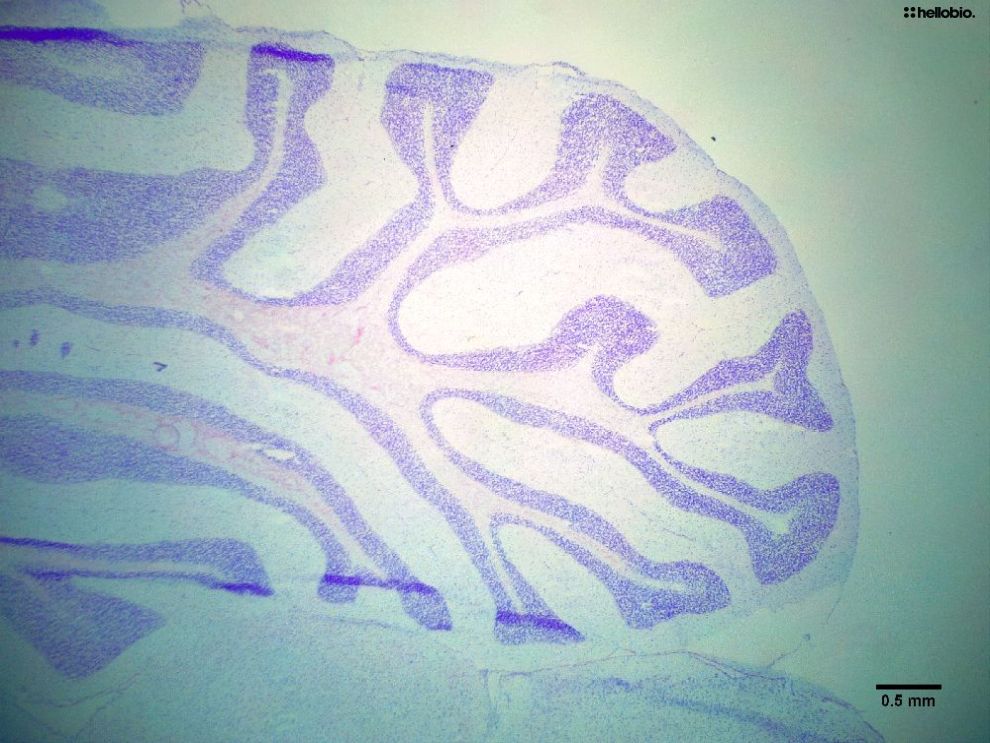 Figure6. Cresyl Violet staining in formalin fixed rat cerebellum