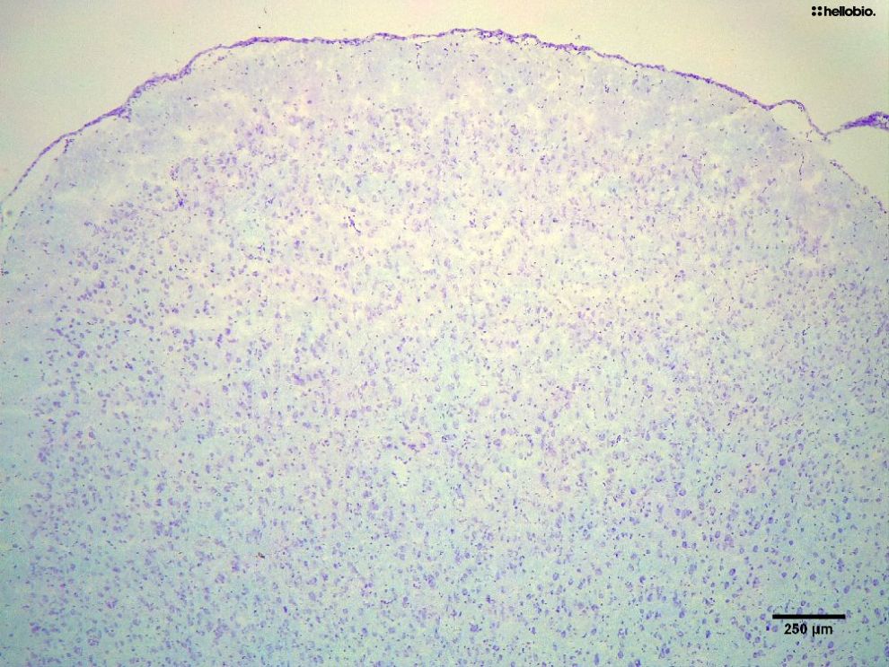Figure7. Cresyl Violet staining in formalin fixed rat prefrontal cortex