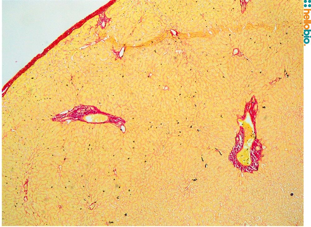 Figure. 7: Picro Sirius red staining in chimpanzee liver. 