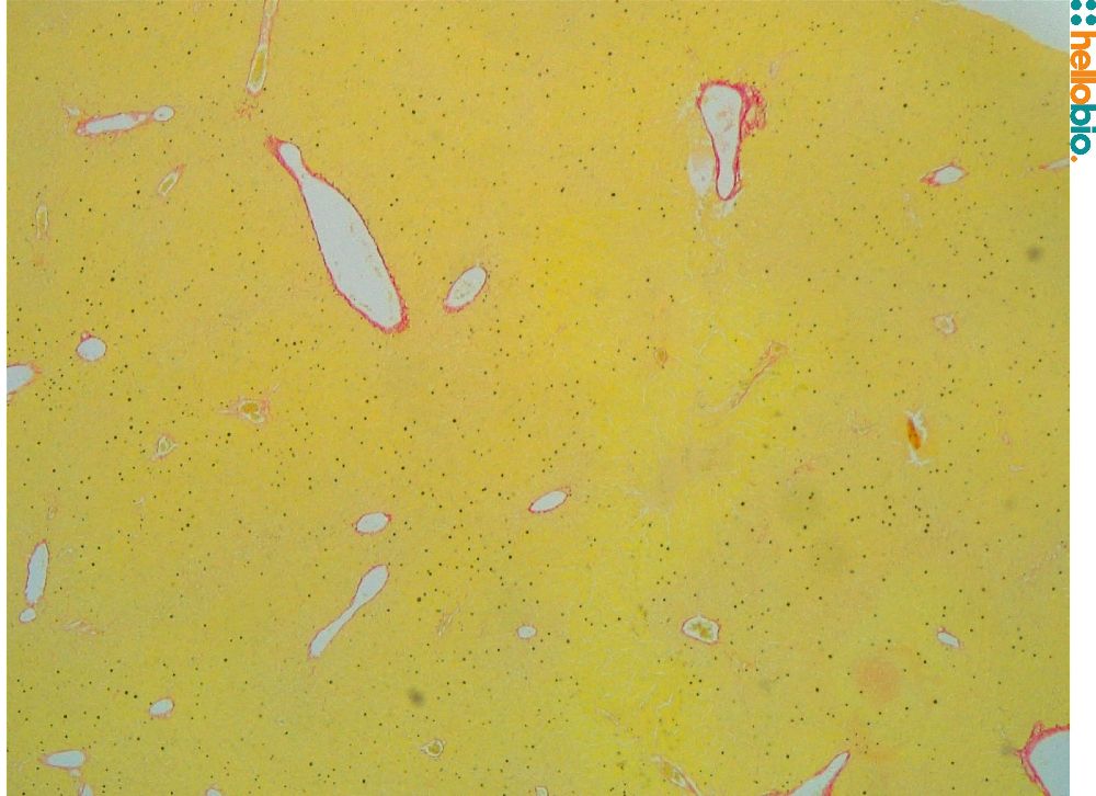 Figure. 9: Picro Sirius red staining in kidney tissue.