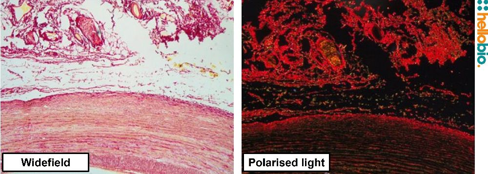 Figure. 11: Picro Sirius red staining in formalin fixed Chimpanzee aorta under both standard widefield illumination and polarised light. 