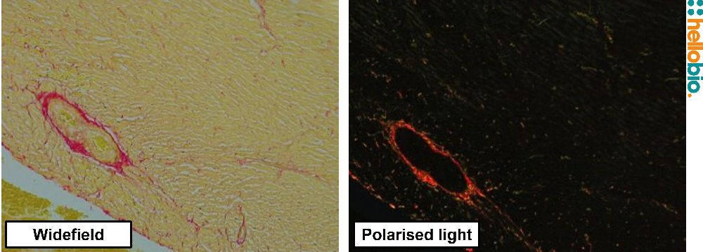 Figure. 12: Picro Sirius red staining in Zenker fixed juvenile cat heart under both standard widefield illumination and polarised light. 
